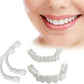 Snap in Teeth for Men and Women | الأسنان التركيب الفوري للرجال والنساء